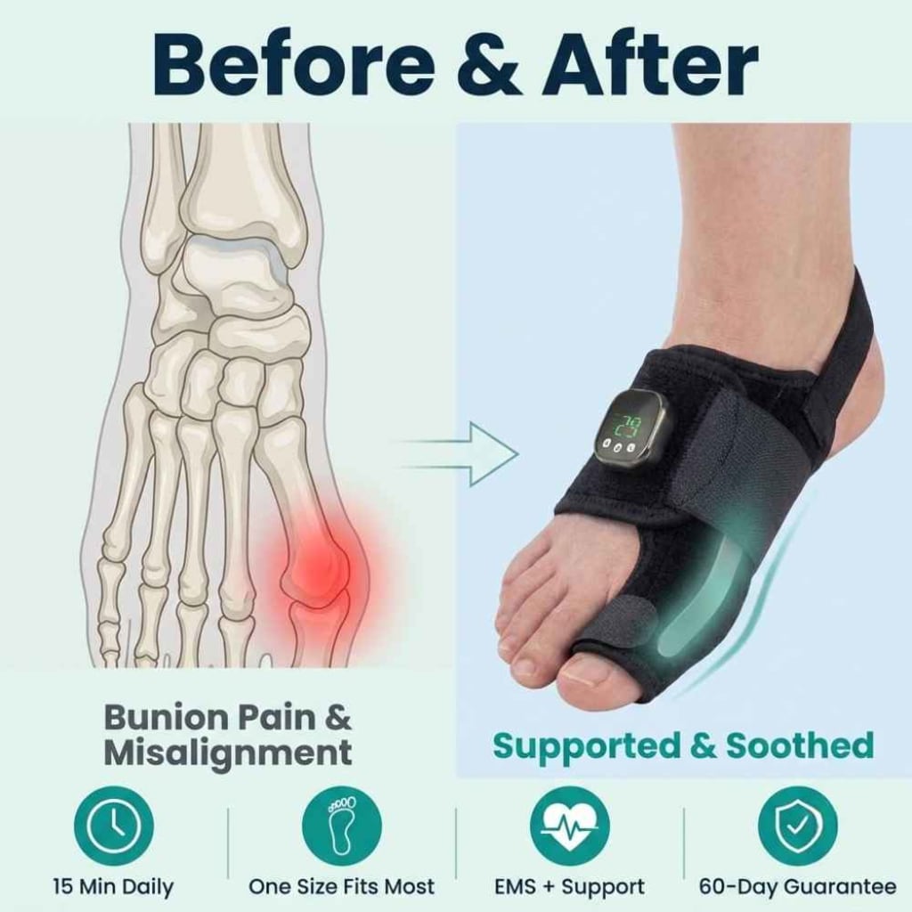 TENDRA — EMS Bunion Corrector